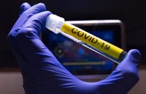 Descubren una cuarta cepa de coronavirus en Uruguay