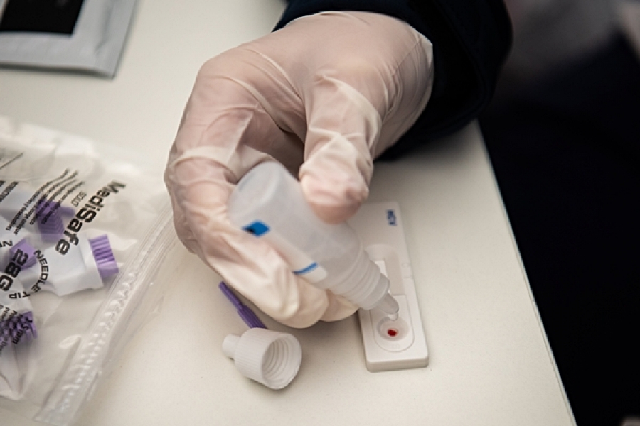 Test rápidos de diagnóstico de hepatitis C