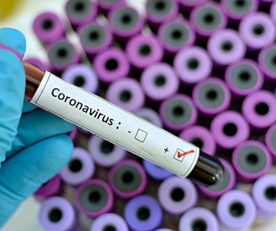 Identifican variante del coronavirus con “múltiples mutaciones”